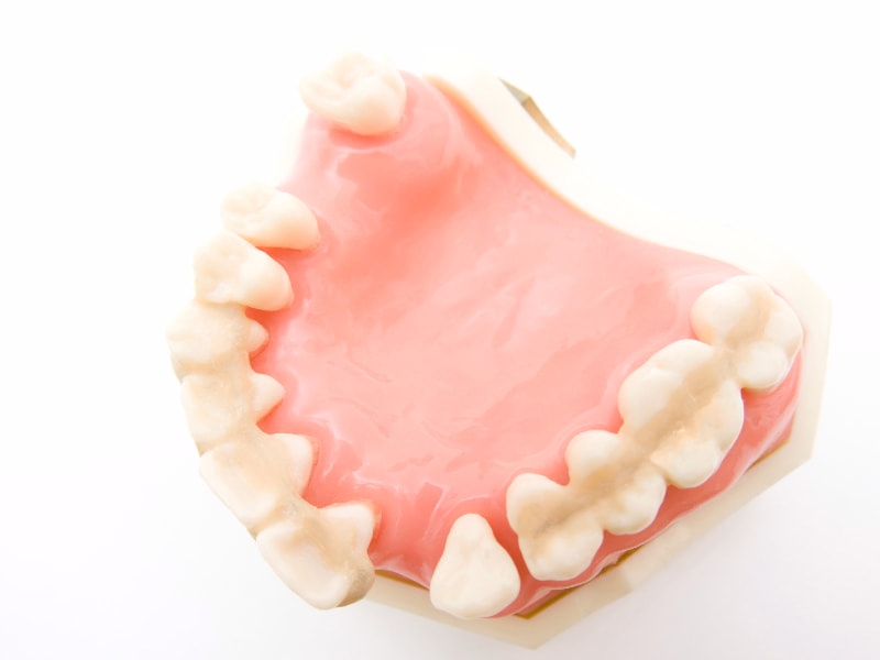 歯周病と全身の病気の深い関係